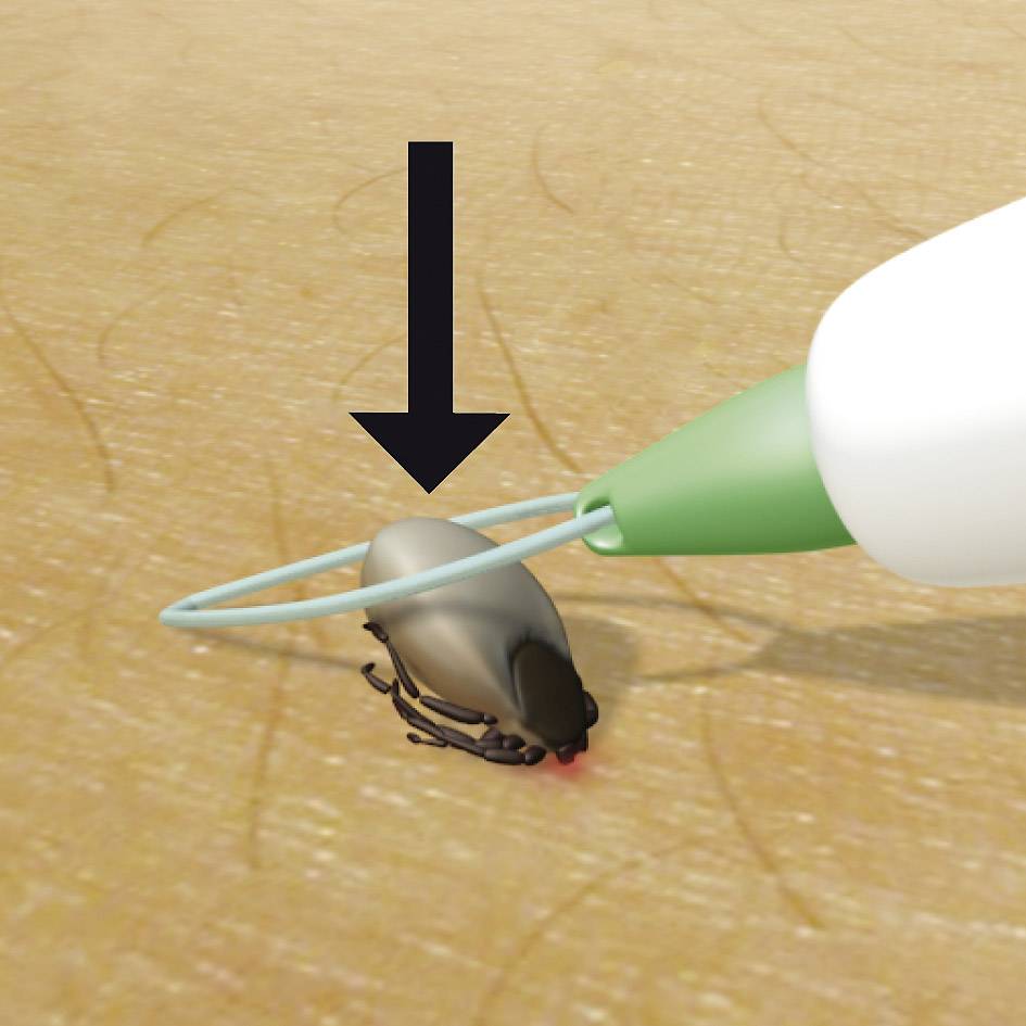 Fjernelse af flåter med en flåtekrog: Flåten fjernes forsigtigt ved en drejende bevægelse. En sort pil viser retningen.