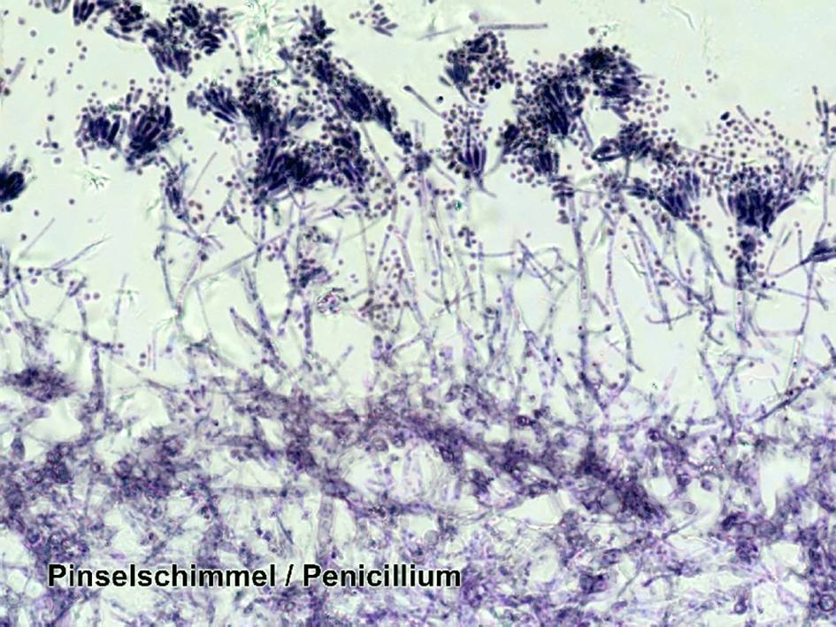 Mikroskopaufnahme von Pinsel- oder Pinselschimmel (Penicillium). Deutliche Strukturen mit verzweigtem Geflecht und sporenähnlichen Elementen.