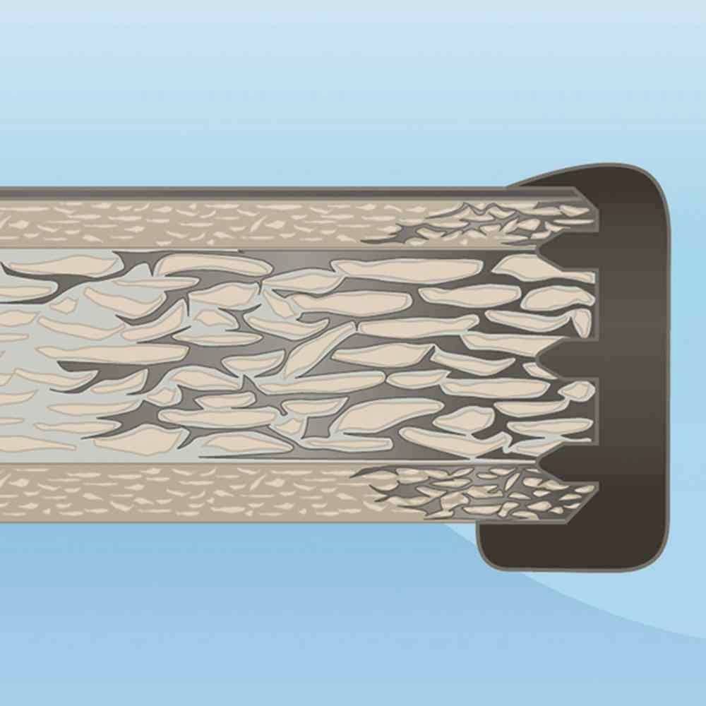 Querschnitt einer Arterie, teilweise verstopft. Links ist die Arterienwand gesund, rechts verdickte Plaques, die den Blutfluss einschränken.