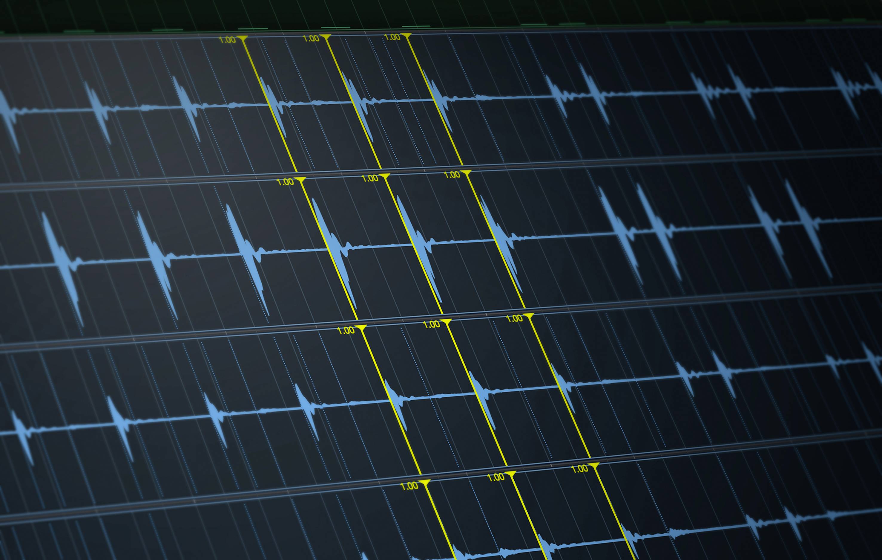 Ein Diagramm mit blauen und gelben Wellenformen auf dunklem Hintergrund zeigt Schall- oder Audiosignalverläufe.