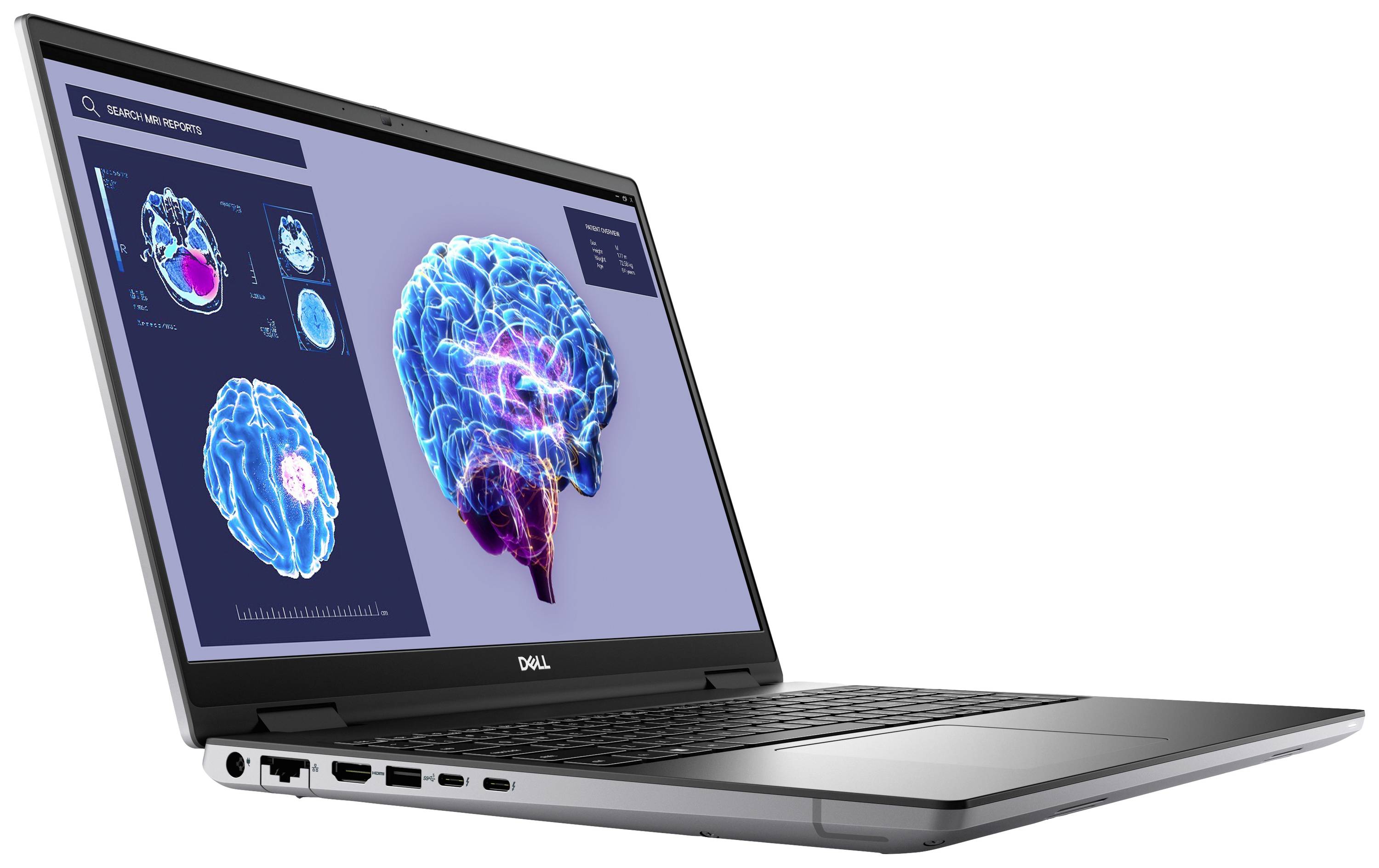 Ein Laptop mit medizinischer Bildgebung auf dem Bildschirm, zeigt mehrere Gehirnscans in lebhaften Farben zur Analyse.