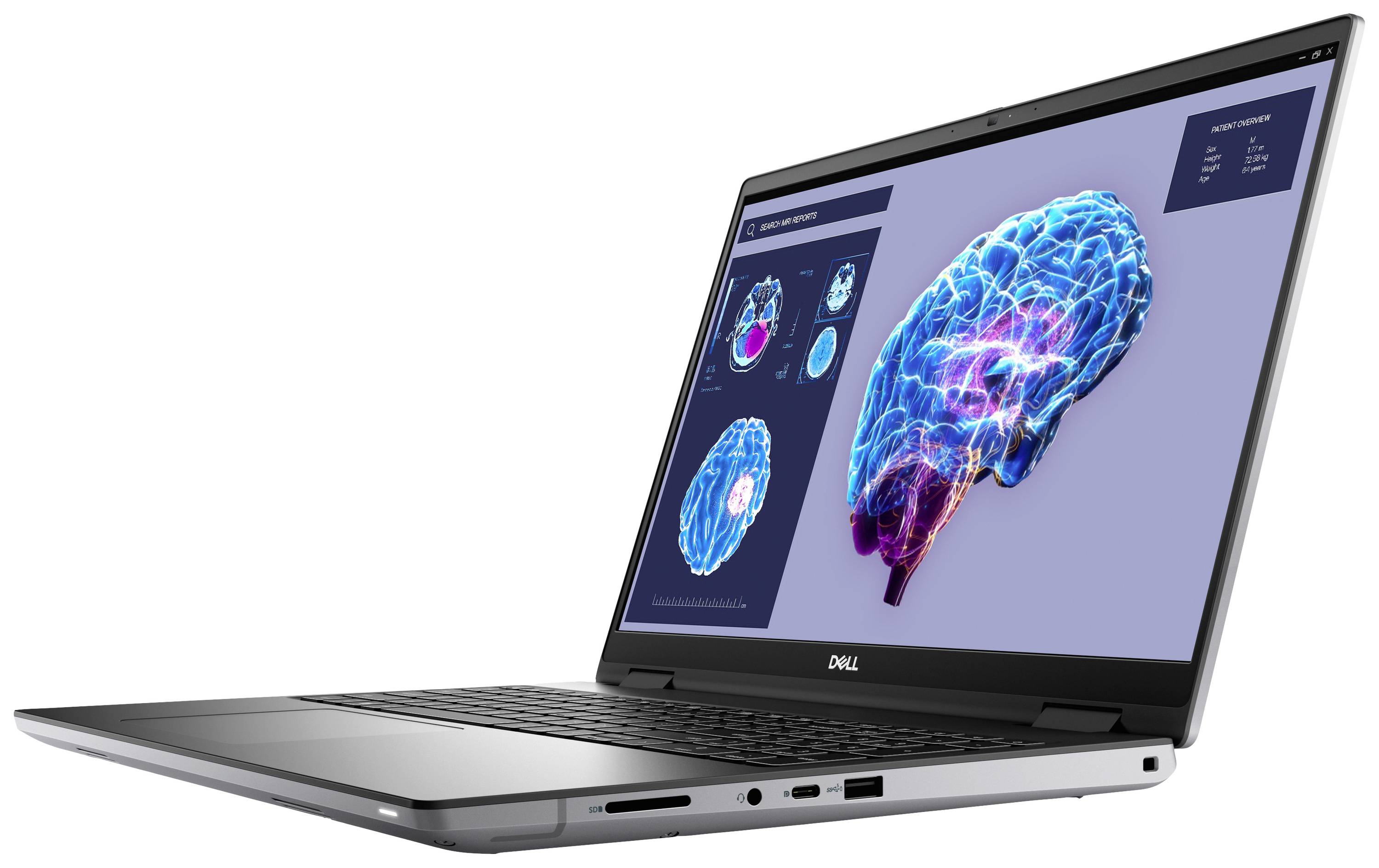 Silberner Laptop, geöffnet, zeigt auf dem Bildschirm ein farbiges Bild eines Gehirns mit Diagrammen und Datenanalyseinformationen.