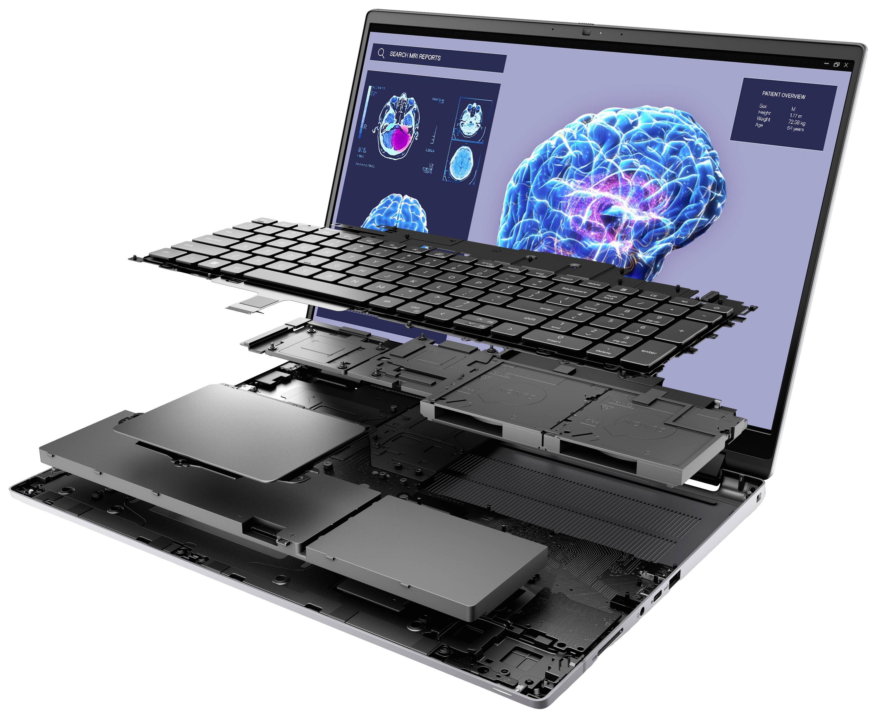 Ein Laptop mit geöffneter Ansicht zeigt interne Komponenten wie Tastatur und Akku. Auf dem Bildschirm sind Gehirndiagramme angezeigt.