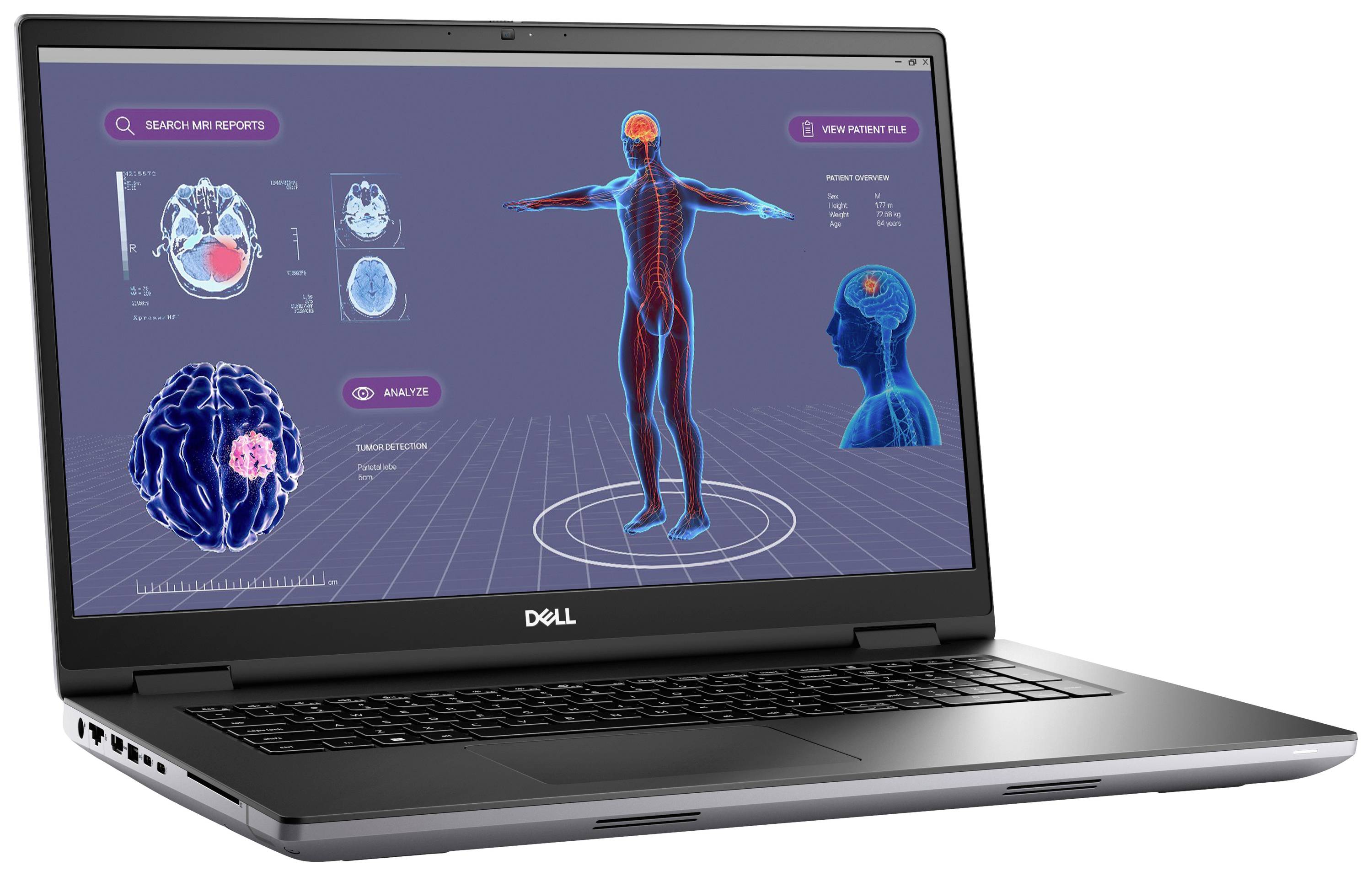 Ein Laptop mit einer medizinischen Software zeigt Körper- und Gehirnscans, hervorgehobene Bereiche in Rot, für Diagnosezwecke.