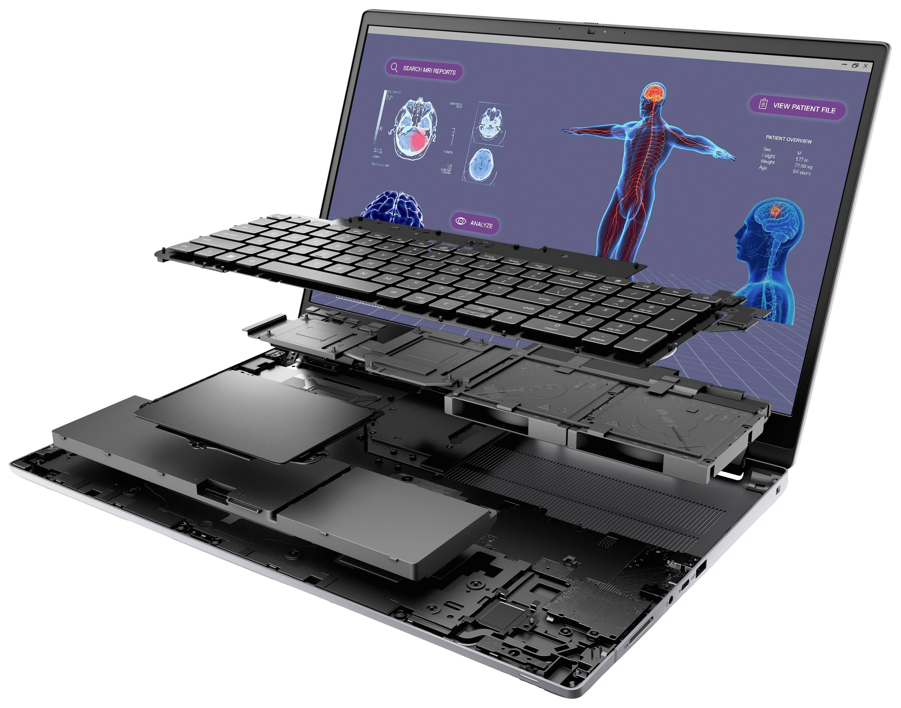 Ein aufgeklappter Laptop zeigt eine medizinische Grafik auf dem Bildschirm. Die Tastatur und interne Komponenten sind teilweise sichtbar.