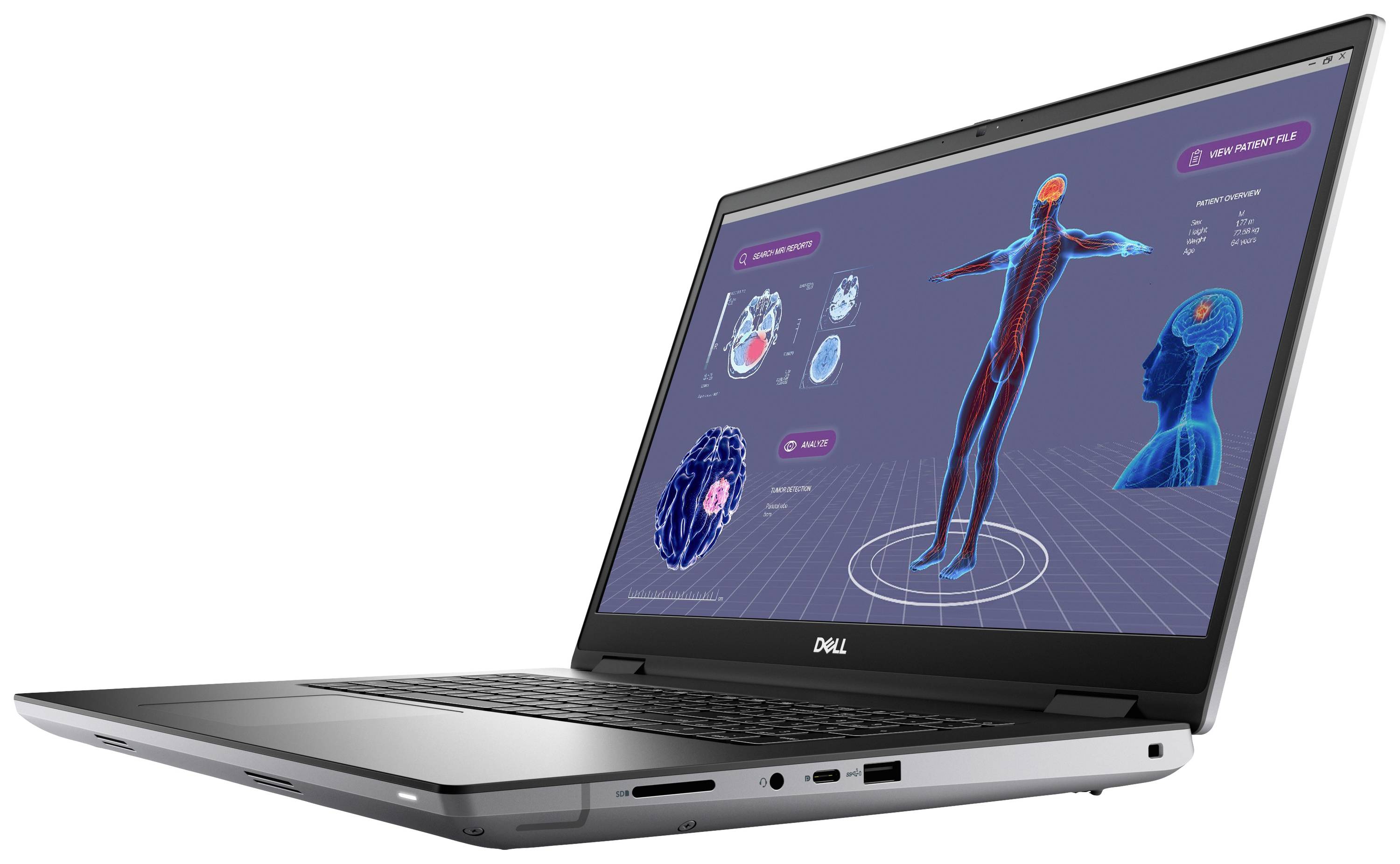 Ein Laptop zeigt ein medizinisches Diagramm mit einem menschlichen Körper, Organen und Gehirnanalysen auf dem Bildschirm.