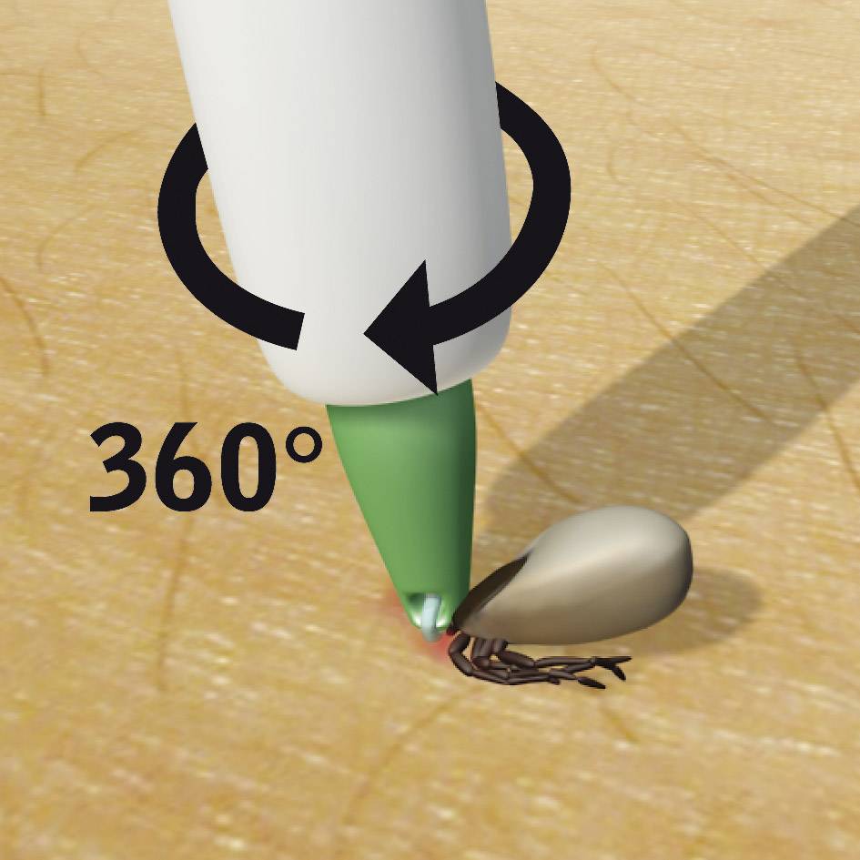 Eine Pinzette entfernt eine Zecke, indem sie im Uhrzeigersinn gedreht wird. Eine 360-Grad-Drehung wird mit einem Pfeil angezeigt.