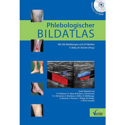Phlebologischer Bildatlas | WVP. Wirtschafts- und Praxisverlag | Eberhard Rabe; Markus Stücker