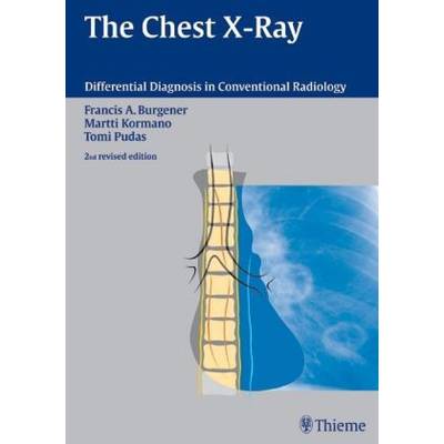 The Chest X-Ray | Thieme | Francis A. Burgener; Martti Kormano; Tomi Pudas; Tomi Pudas