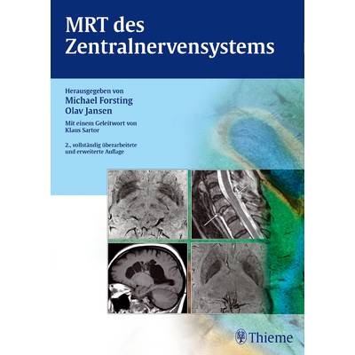 MRT des Zentralnervensystems | Thieme | Michael Forsting; Olav Jansen