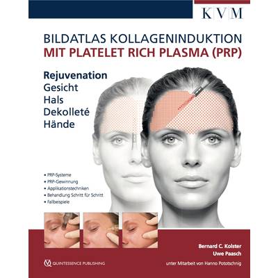 Bildatlas Kollageninduktion mit Platelet Rich Plasma (PRP) | KVM - Der Medizinverlag | Uwe Paasch; Bernard C. Kolster