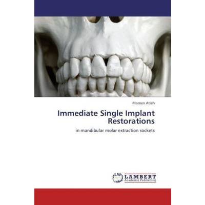 Immediate Single Implant Restorations