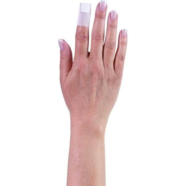 Fingerkuppenverband aluplast el. 10 St./Pack.-1