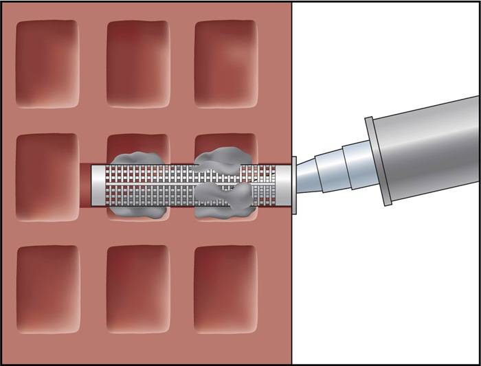 Verbundmörtel ResiFIX VY SF VY 300 SF Vinylester,styrolfrei ETA 1 CELO-10