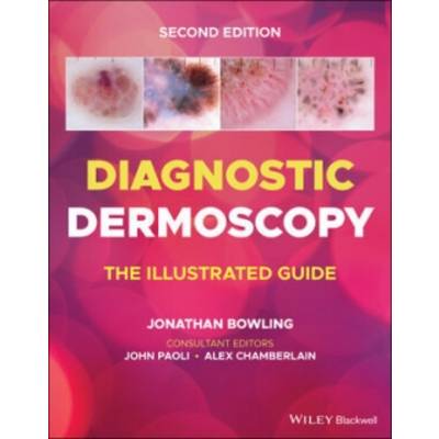 ;Diagnostic Dermoscopy | Wiley John + Sons; John Wiley & Sons Inc | Bowling, Jonathan; Paoli, John; Chamberlain, Alex
