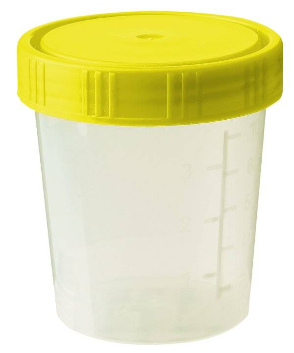 neoLab® Becher 100 ml mit Schraubdeckel gelb, montiert, unsteril, 48x5 (=240) Stck./Pack-0