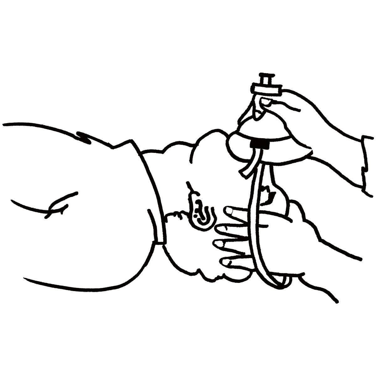 Wero Beatmungsmaske, Taschenmaske mit Anschluss für Sauerstoffzufuhr-4