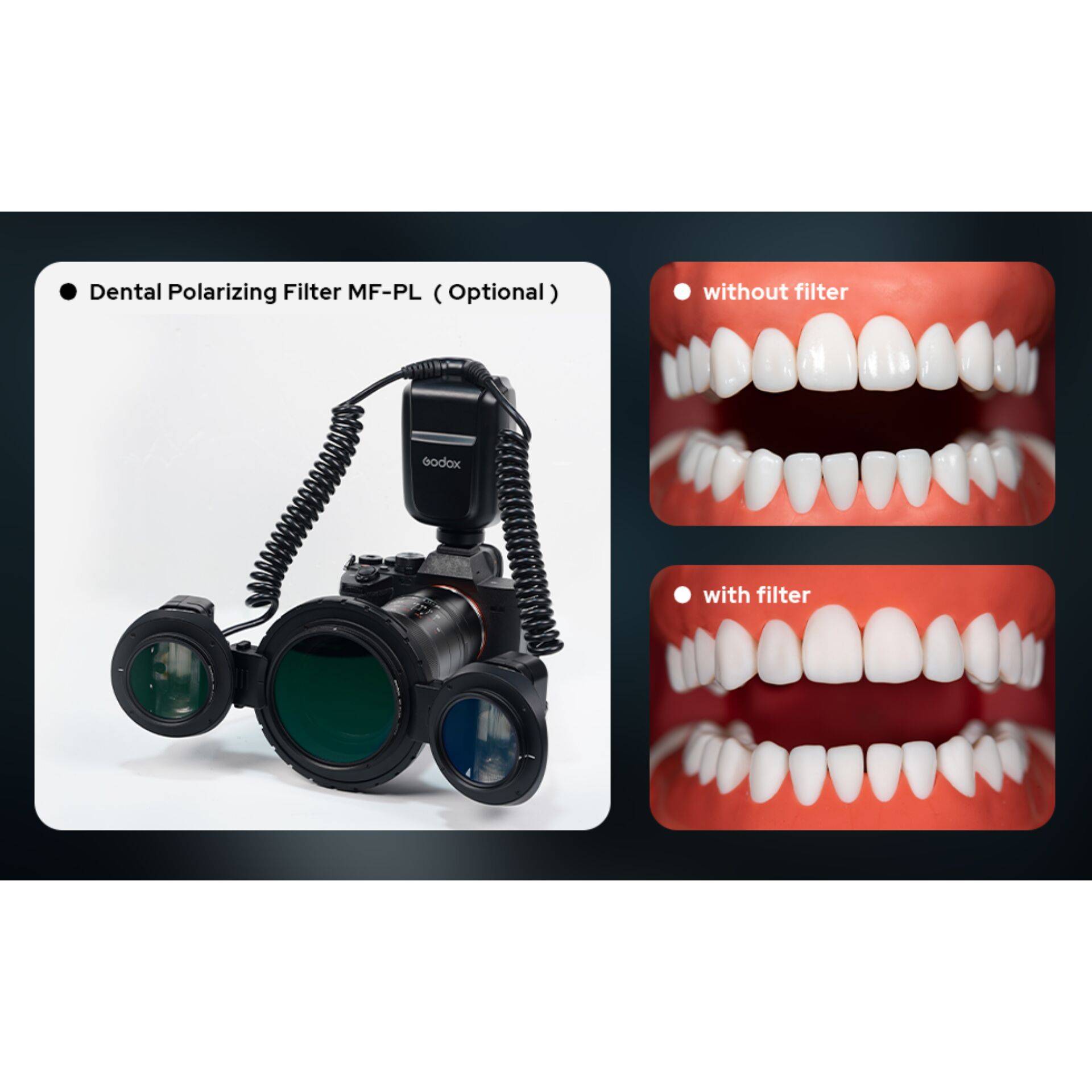 Godox MF-PL Zahnärztliches Polarisationsfilter-Set-1