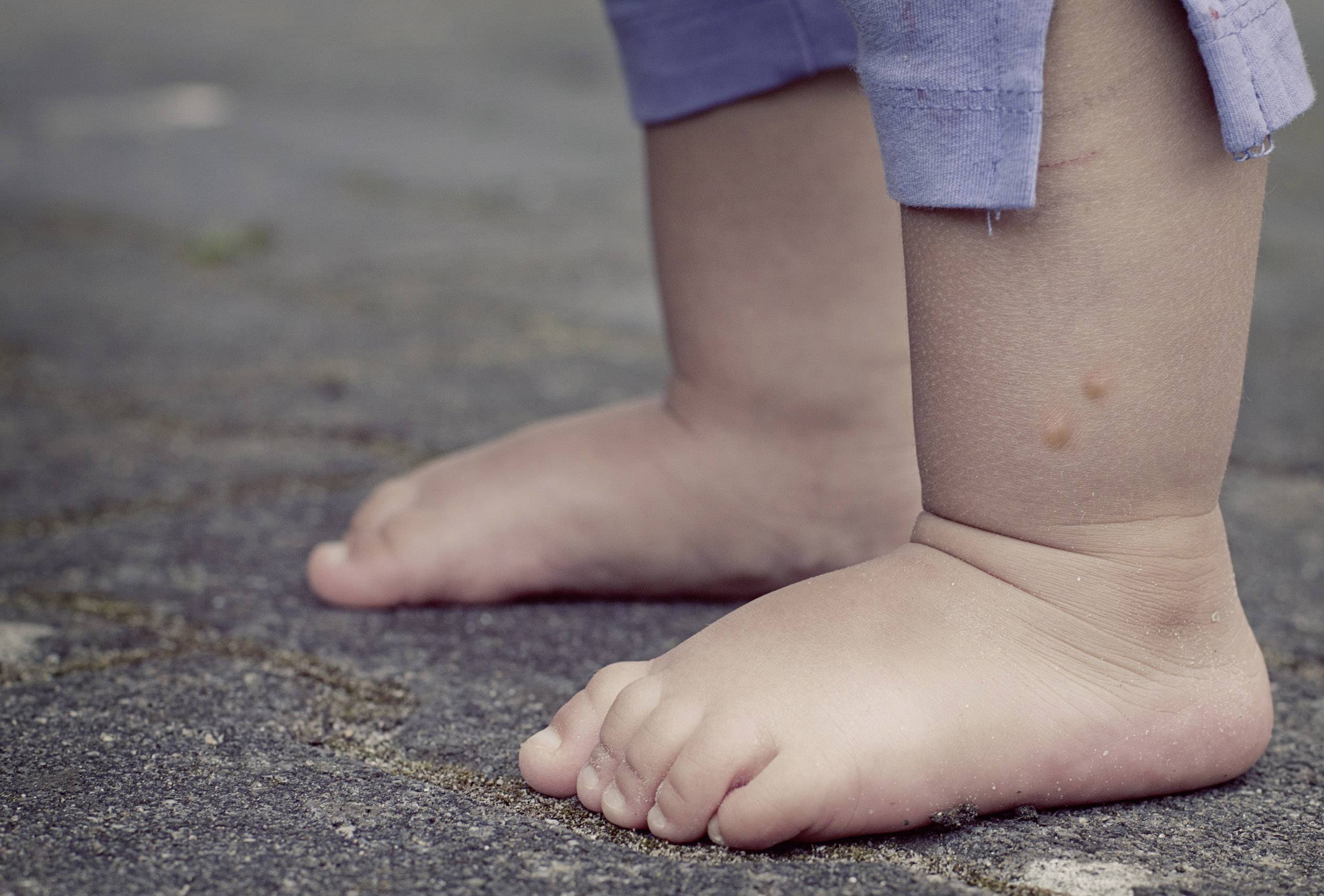 Toddler's feet stand on a grey floor. The child is wearing rolled-up blue trousers.