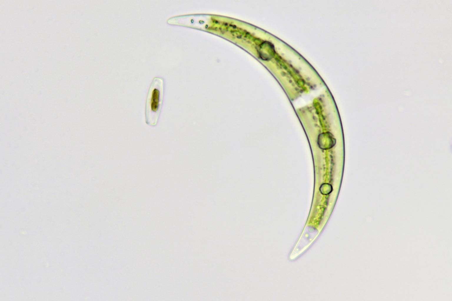 Microscopic view of a crescent-shaped green algae on a white background. Two additional small algae are visible.