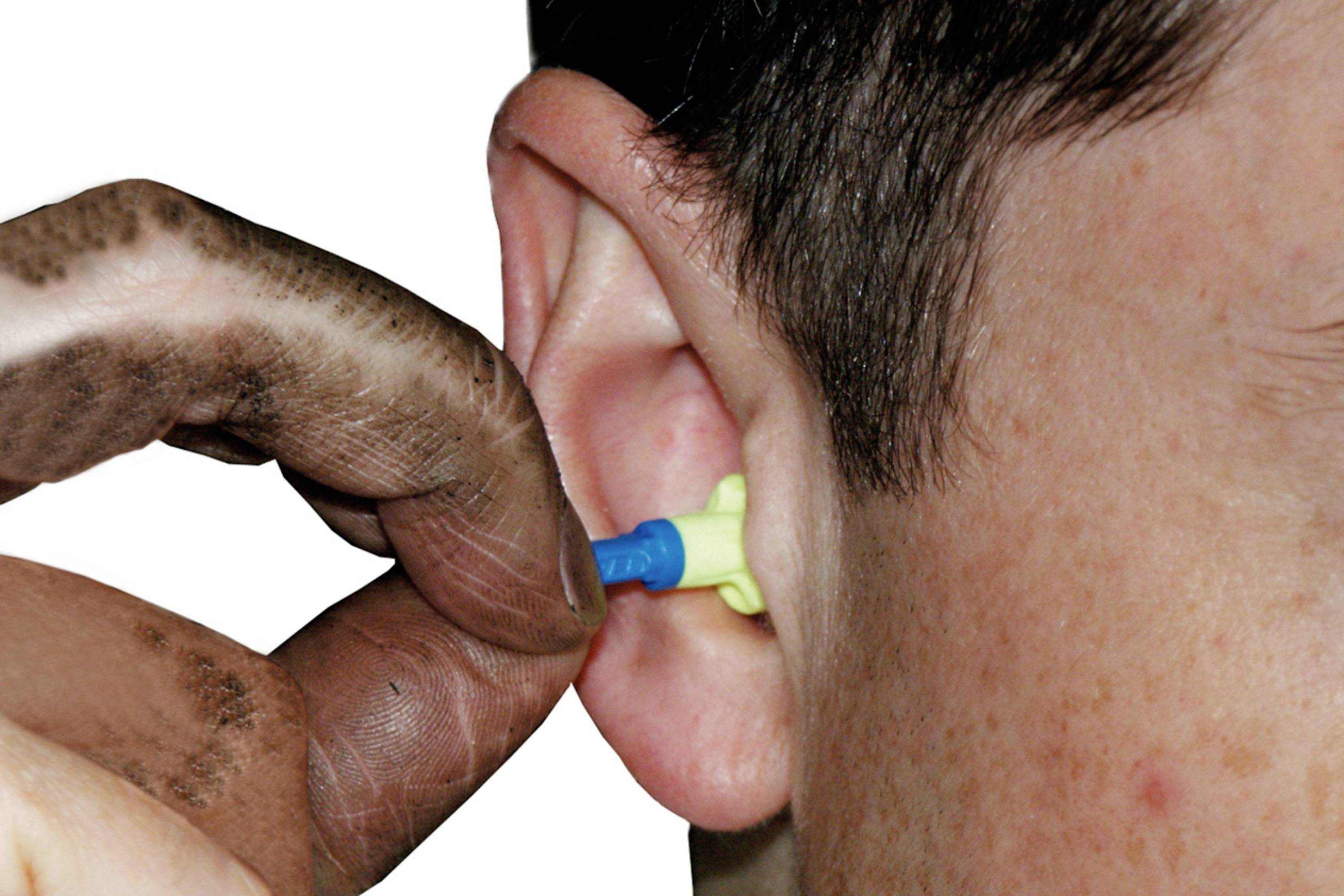 A person with a dirty finger is inserting a yellow earplug into their ear.