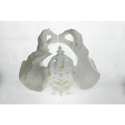 3D-printed model of a human pelvis, frontal view. Shows complex bone structures and anatomical details.
