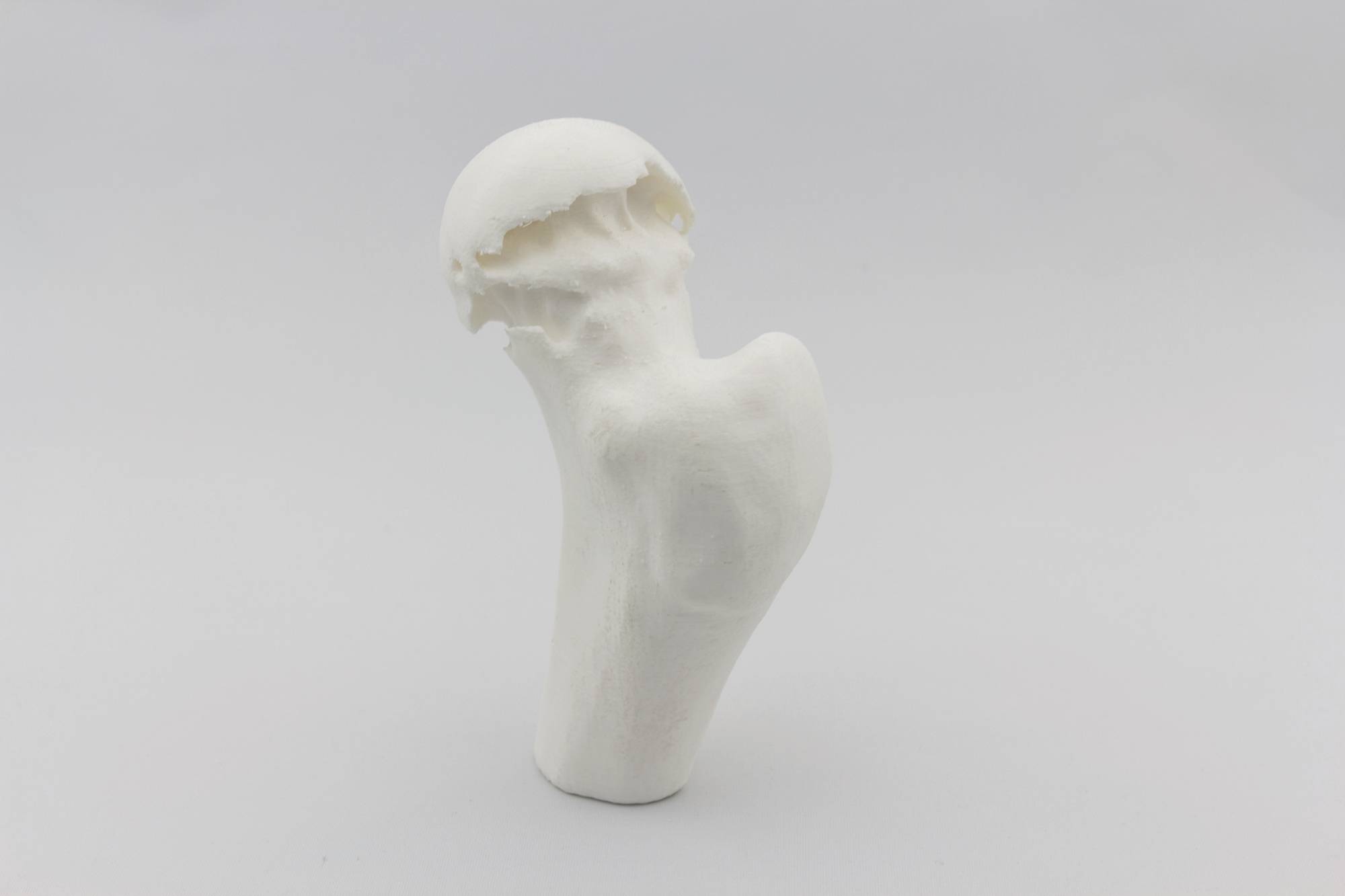 A white 3D model of a femur against a neutral background, showing the natural shape and structure of the bone.