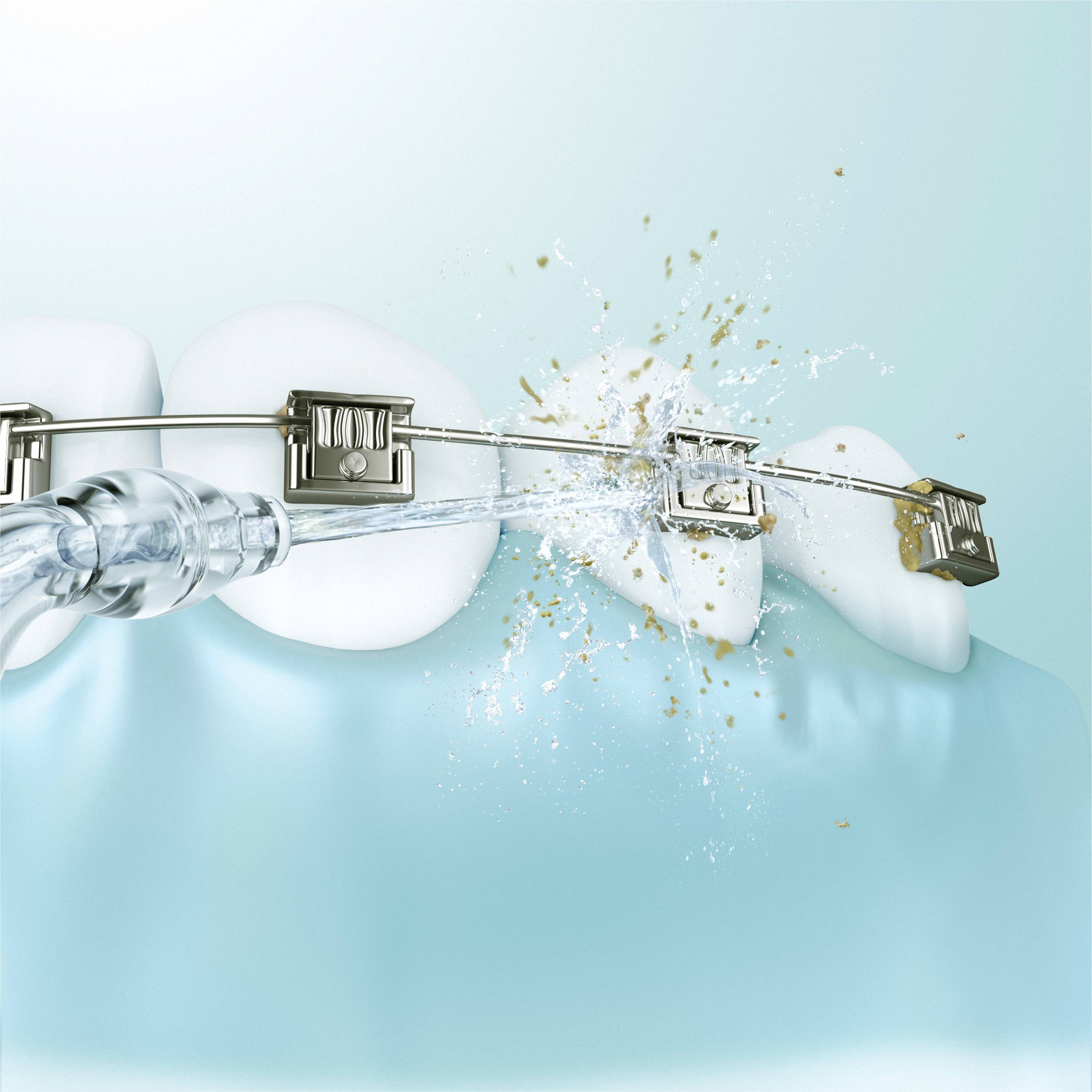 Brace cleans itself with a water jet between the teeth. Dental care for fixed braces is illustrated.