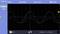 'Oscilloscope shows two sine waves with different amplitudes on channels 1 and 2, blue and yellow lines, on a grid diagram.'
