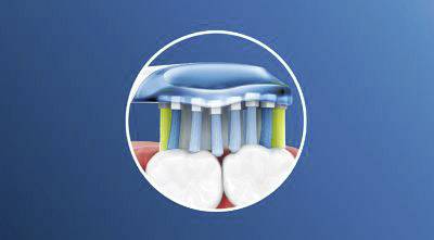 Close-up of a toothbrush with a blue head, its bristles bending during teeth cleaning to ensure thorough cleaning. Blue background.
