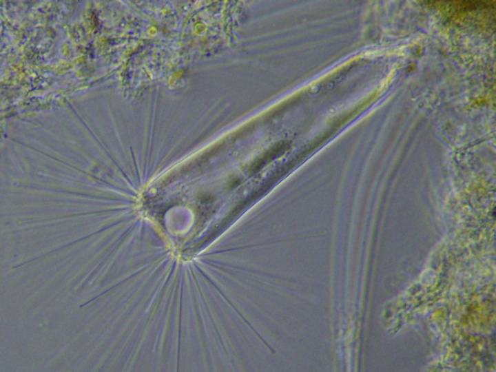 Image agrandie d'une espèce de diatomée microscopique sous forme de bâton transparent avec de fines soies radiales.