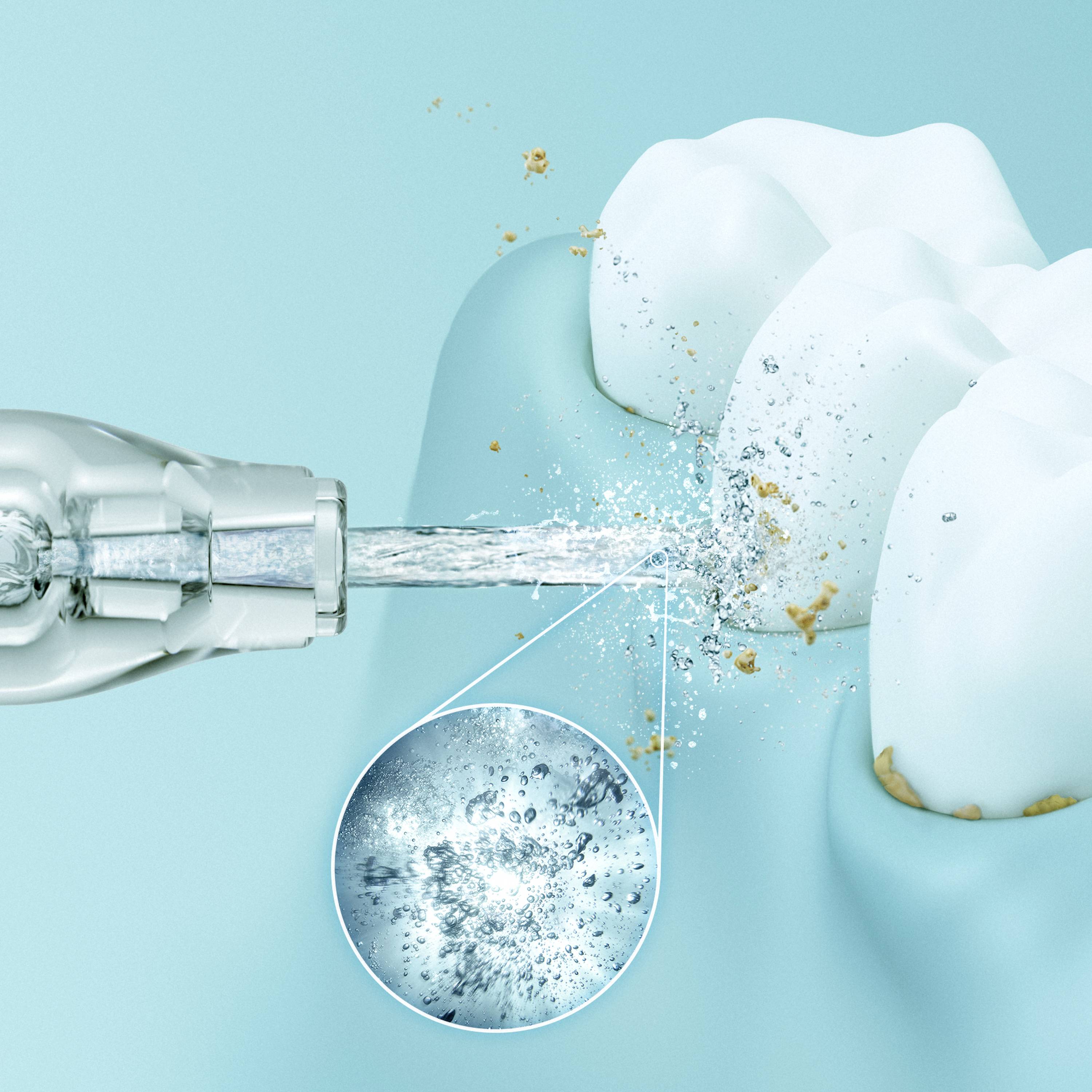 La jet dentaire projette de l'eau sur les molaires, éliminant les restes alimentaires et la plaque dentaire. Vue agrandie montrant l'effet de nettoyage.