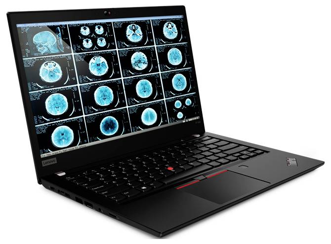 Un ordinateur portable affichant plusieurs images de scanner cérébral médical sur son écran, suggérant une utilisation pour l'analyse et le diagnostic médical.