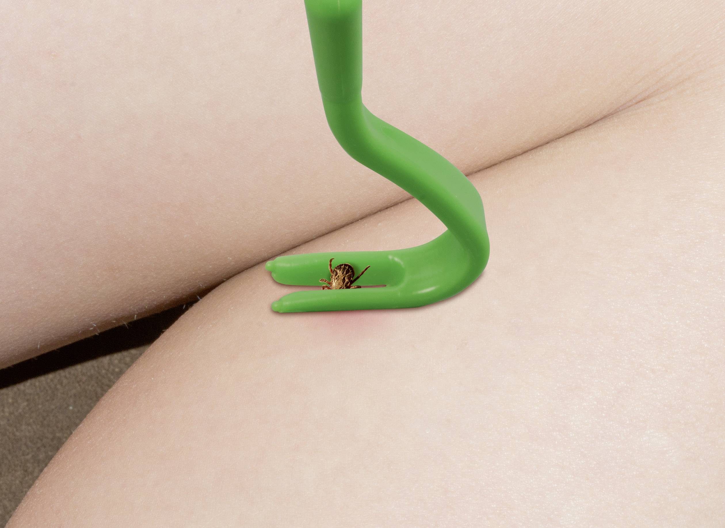 Une tique est retirée de la peau claire à l'aide d'un outil vert.