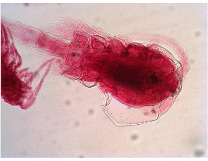 Mikroskopski snimak parazita obojen crvenom bojom. Parazit je izdužen s jasno vidljivim segmentima i anatomskim detaljima.
