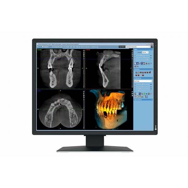 EIZO RadiForce MX217-SB Monitor PC 53,3 cm [21] 1200 x 1600 Pixel UXGA LCD Nero (2MP EIZO RADIFORCE MX217-SB)-0