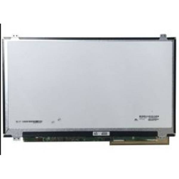 Lenovo 01EN100 Notebook-Ersatzteil Anzeige (01EN100)