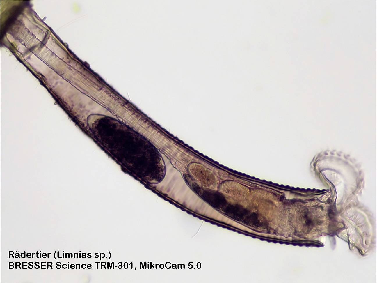 Microscopische opname van een raderdier (Limnias sp.) met een lange, transparante structuur en een rond kopgedeelte.