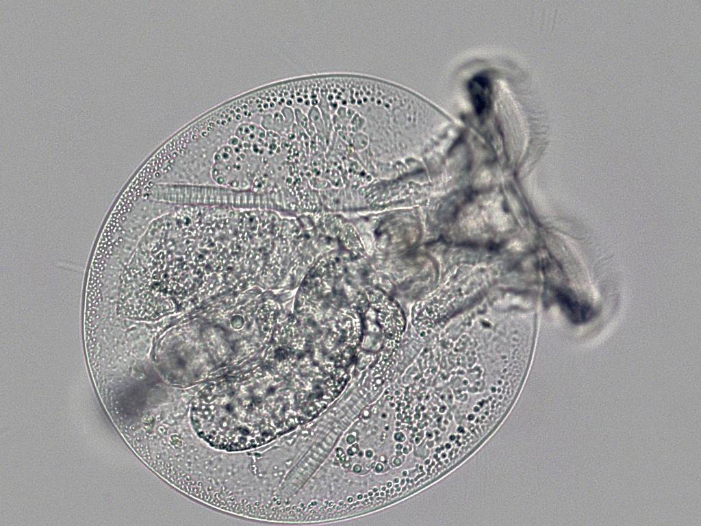 Een microscopisch organisme, waarschijnlijk een eencellige, is zichtbaar binnen een cirkelvormige omlijning, met complexe interne structuren.