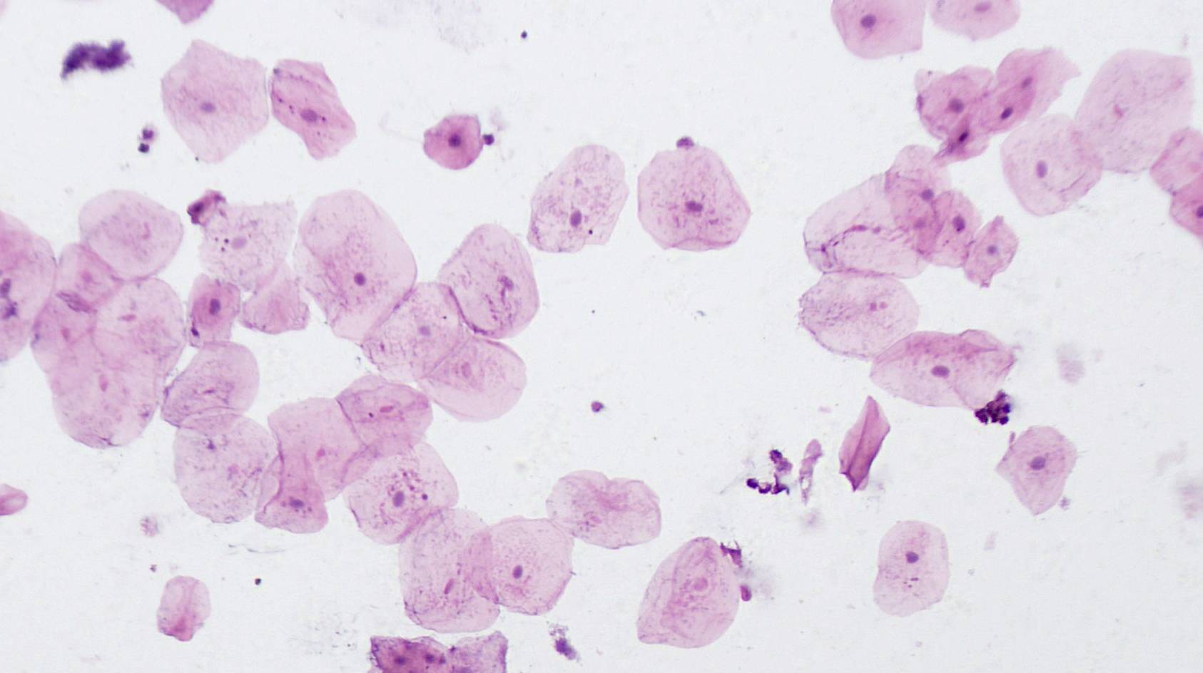 'Microscopische opname van roze gekleurde cellen, willekeurig verspreid. De cellen vertonen gedetailleerde structuurkenmerken onder de microscoop.'