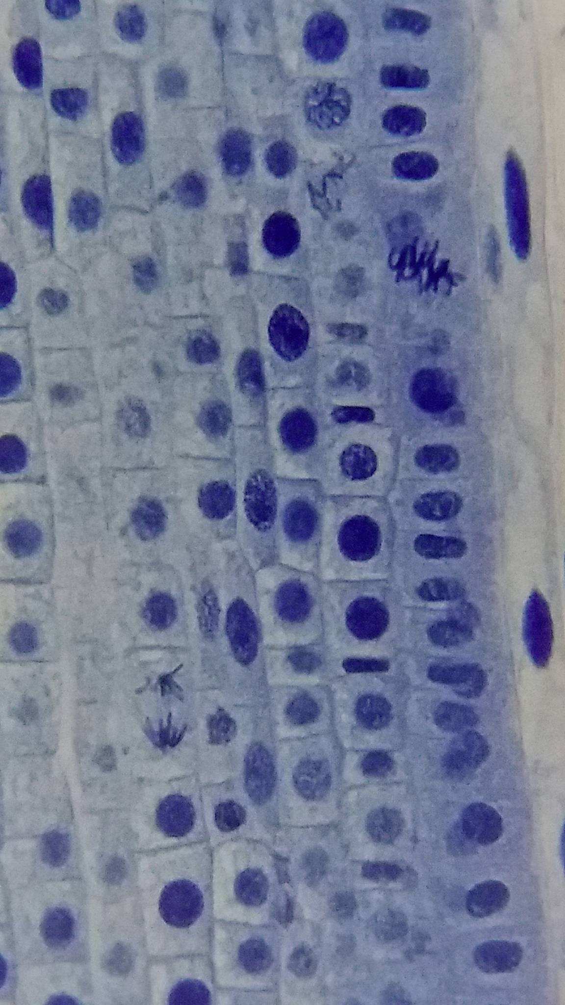 Blauw gekleurde plantencellen onder de microscoop, met duidelijk herkenbare celkernen en celstructuren.