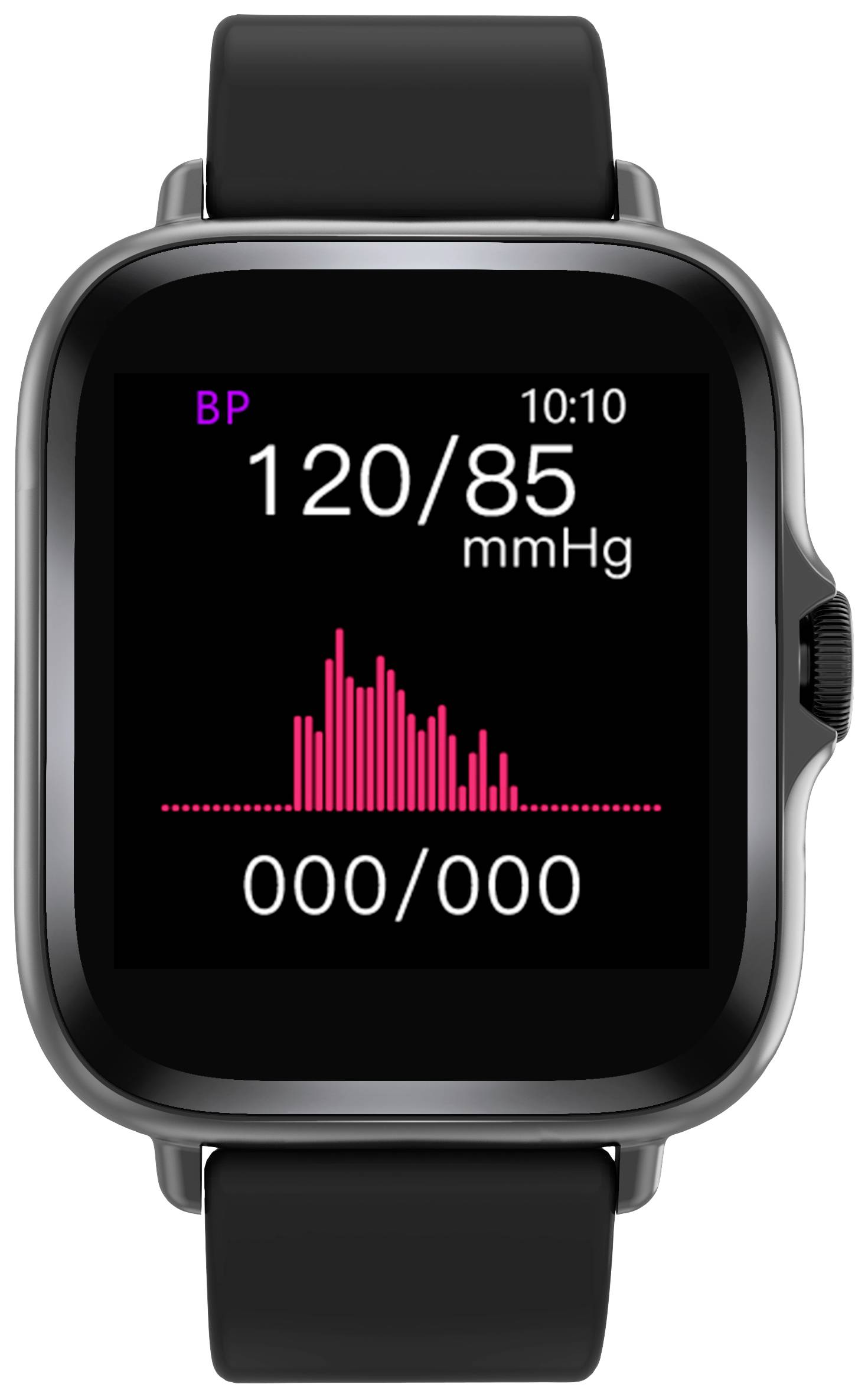 Smartwatch met weergave van bloeddruk: 120/85 mmHg. Diagram toont hartslag. Tijd: 10:10. Bandje zwart.