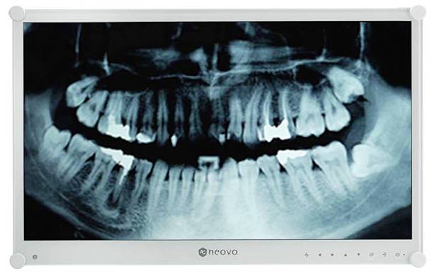 AG Neovo LCD-monitor Energielabel E (A - G) 60.5 cm (23.8 inch) 1920 x 1080 Pixel 16:9 5 ms VA LCD-3