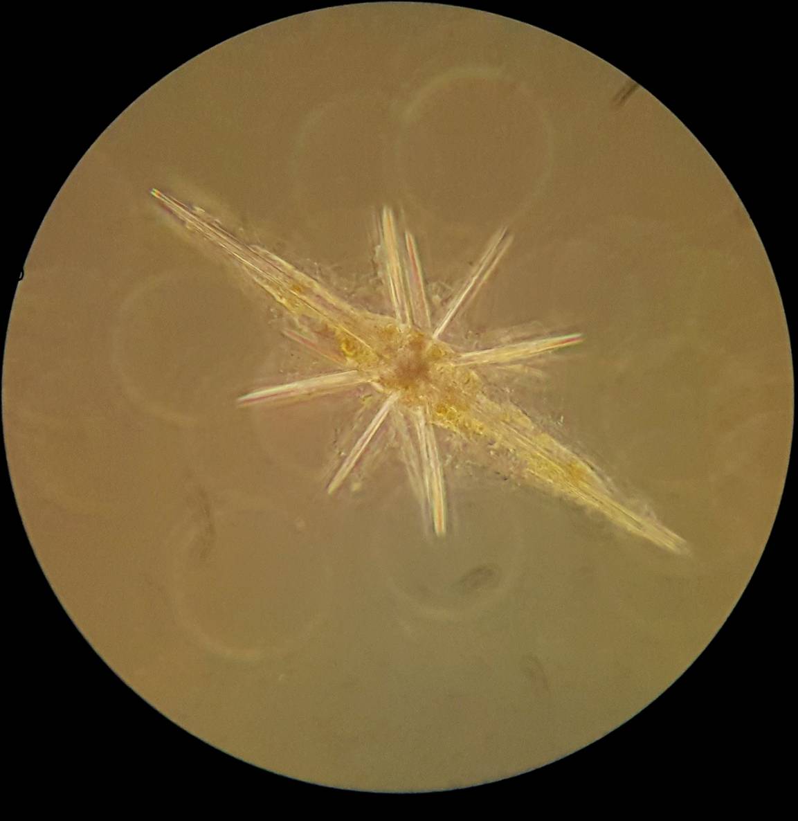 'Zdjęcie mikroskopowe jednokomórkowego planktonu o strukturze gwiaździstej i podłużnych wypustkach na pomarańczowym tle.'