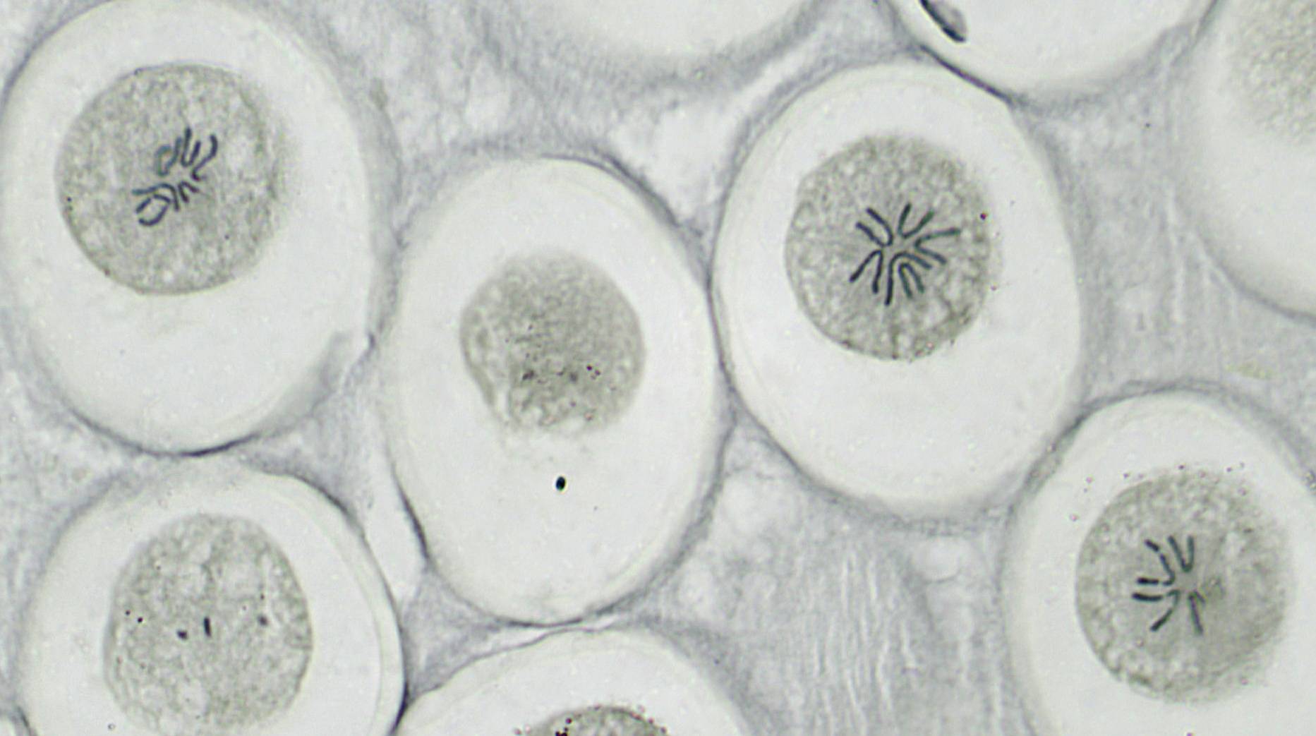 'Mikroskopowy obraz komórek w trakcie podziału. Niektóre komórki prezentują układ chromosomów podczas mitozy.'