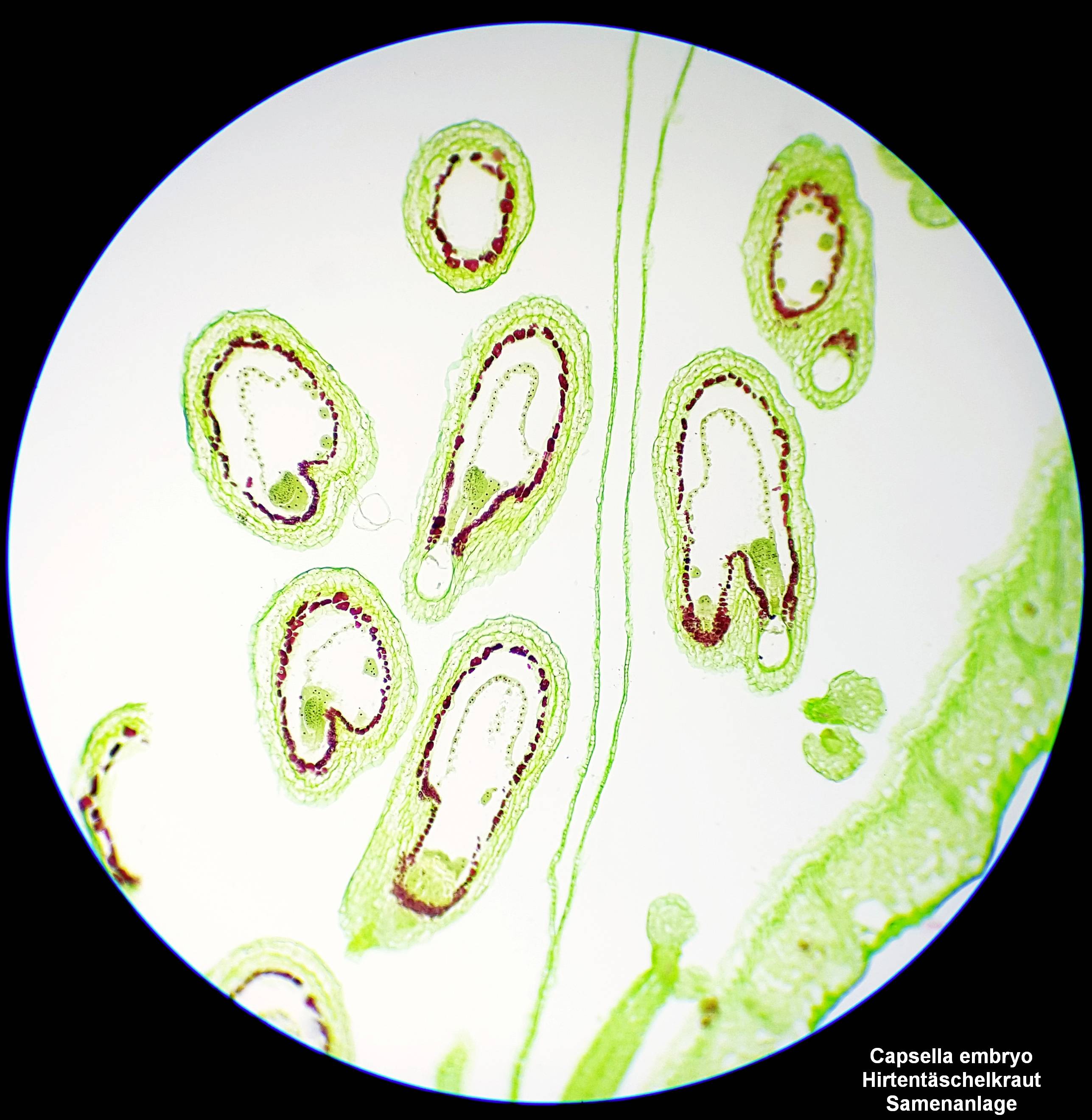 Przekrój poprzeczny zarodków rośliny Hirtenstäfelkraut pod mikroskopem, zabarwiony na zielono i czerwono. Dolna krawędź: opis rośliny.