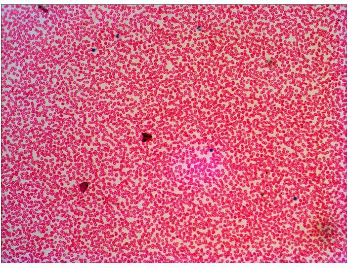 Mikroskopowe zdjęcie okrągłych, czerwono zabarwionych bakterii równomiernie rozłożonych na jasnym tle.