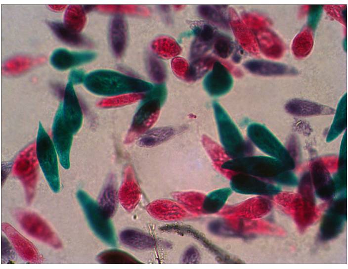 Mikroskopowe zdjęcie przedstawia różne komórki drożdży w kolorach czerwonym i zielonym na neutralnym tle.
