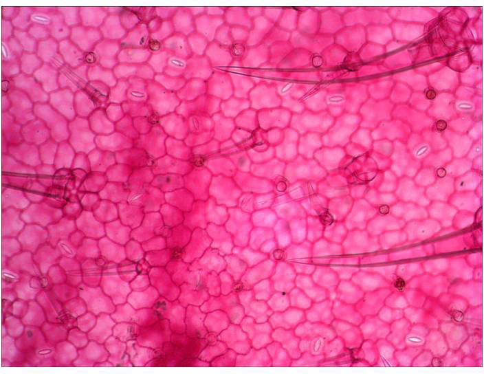 Mikroskopowy obraz komórki roślinnej z siateczkowatymi strukturami komórkowymi w intensywnym różu, ukazujący ściany komórkowe i kilka ciemniejszych punktów.
