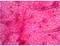 Mikroskopowy obraz komórki roślinnej z siateczkowatymi strukturami komórkowymi w intensywnym różu, ukazujący ściany komórkowe i kilka ciemniejszych punktów.